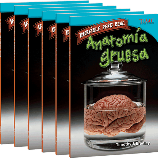 Increíble pero real: Anatomía gruesa 6-Pack